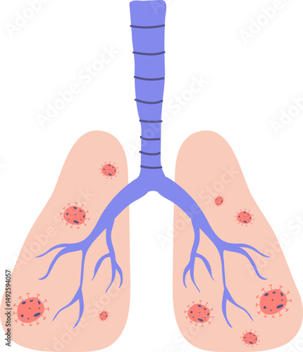 Hand-Drawn Lungs Vector: Depicting Respiratory Infection