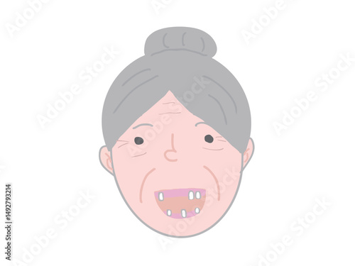 Illustration of the face of an elderly woman who has periodontal disease and has lost her teeth