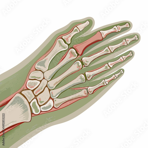 Illustration of a Human Hand with Highlighted Fractured Finger Bone, Showing Detailed Bone Structure and Injury Representation in a Medical Context on a Colored Background