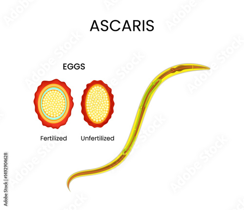 Ascaris of Worm and Eggs