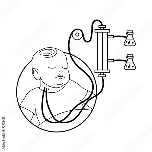 Infant hemodialysis. Connecting a child to a hemodialysis machine through a central vein, jugular. Medical poster, vector illustration