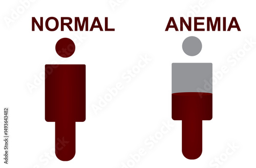 Normal and anemia icon. vector