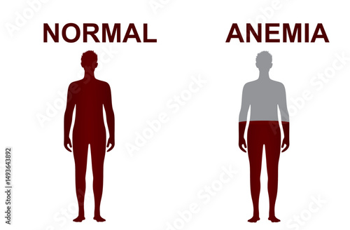 Normal and anemia icon. vector