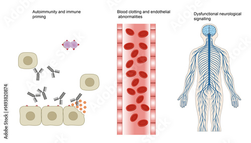 Multi-System Pathophysiology: Autoimmunity, Coagulation & Neurological Dysfunction
