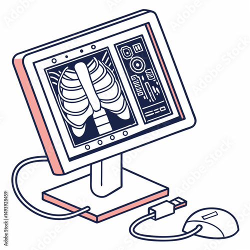 Professional medical xray image on computer screen with mouse