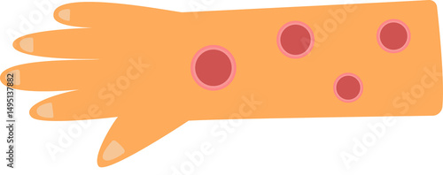 leishmania disease concept. sandfly carrier of leishmania disease