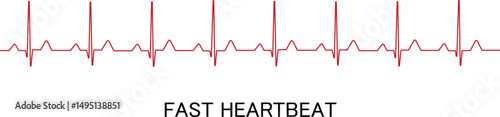 Tableau sur toile Fast Heartbeat vector illustration red colour Graphs of a fast heartbeat isolated on a white background