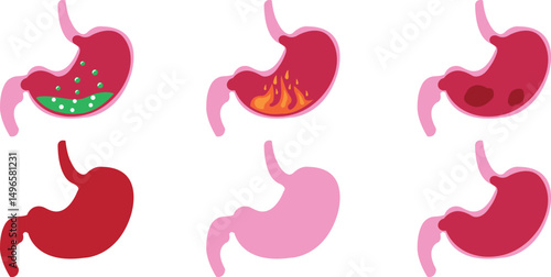 Human stomach icons collection. Gastroparesis, Stomach Disease, Medical and Health, Healthy Eating. vector illustration. Anatomy body part