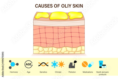 Causes of oily skin. Oily and damaged skin layer. Vector for advertising about beauty and medical treatment.