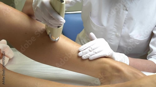 Laser hair removal of legs close-up. Natural natural process of laser hair removal of legs with Alexandrite laser with flashes.