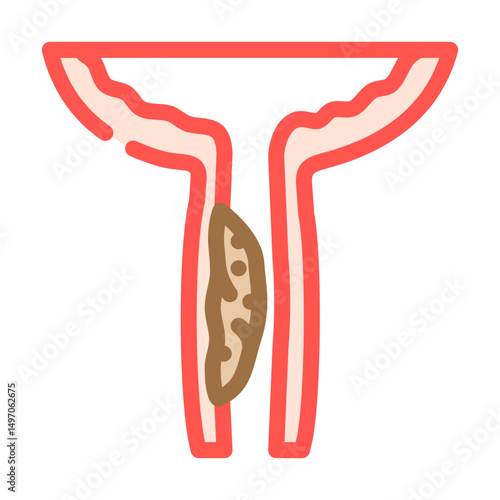 urethral stricture urology color icon vector illustration