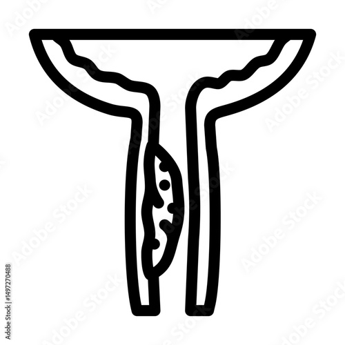 urethral stricture urology line icon vector illustration