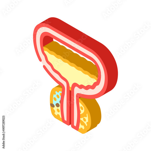 prostatectomy urology isometric icon vector illustration