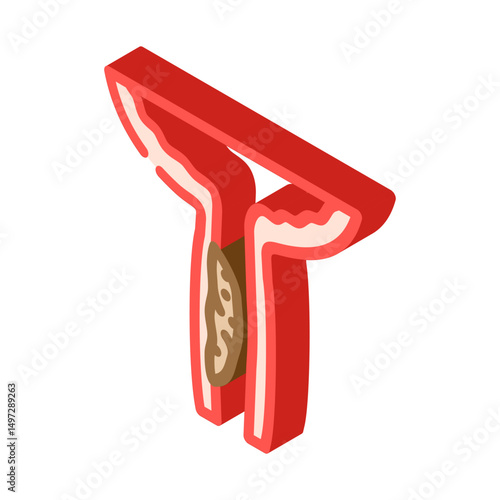 urethral stricture urology isometric icon vector illustration