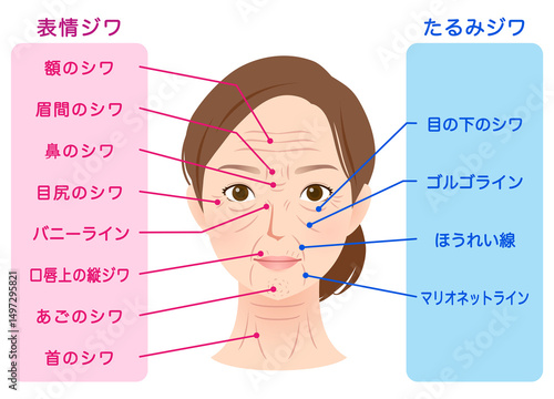 シワの種類　女性の顔　美容