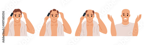 Baldness stages. Hair loss process. Bald man head. Human balding. Hairless male. Trichology disease symptoms progress. Hairstyle density. Haircut or calvity. Vector alopecia concept