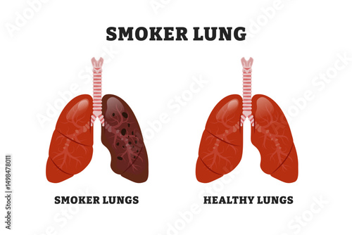 Healthy vs Smoker Lung, educational medical poster design healthcare scheme, human lung disease internal organs. Labeled emphysema and chronic obstructive pulmonary disease (COPD).