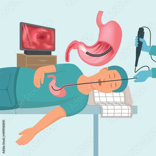 Illustration of a sedated patient undergoing gastroscopy. A flexible endoscope is inserted through the mouth into the stomach, with a monitor showing internal images