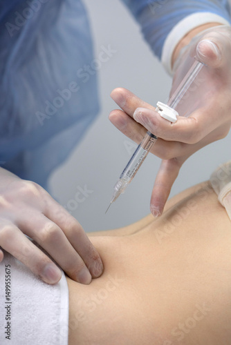 Physiotherapist doing an injection to the back of a patient