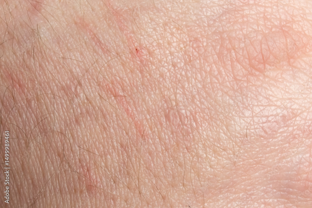 Fototapeta premium light caucasian skin texture macro
