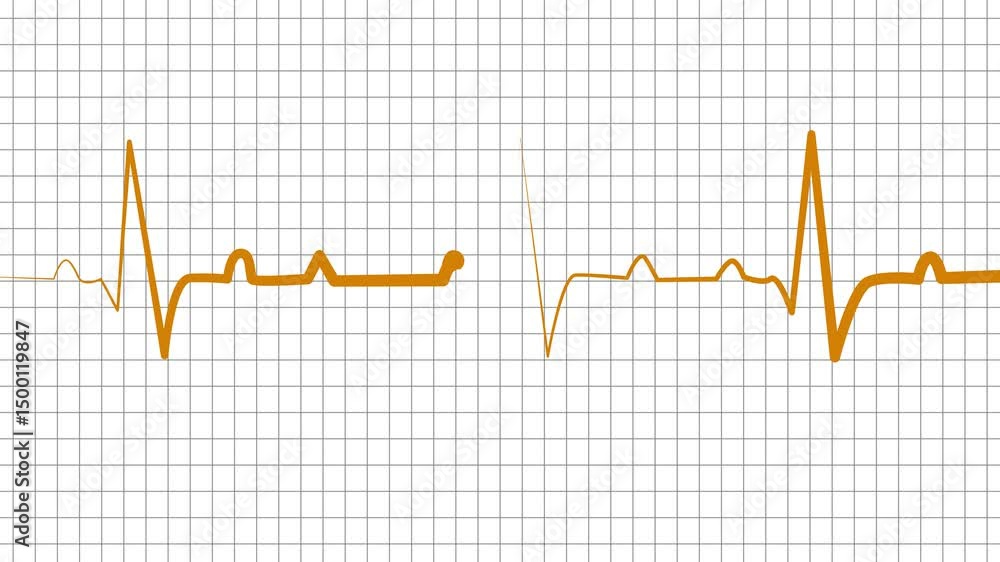 Stylized ECG Heartbeat Line Animation on Grid Background Stylized ECG Heartbeat Line Animation on Grid Background