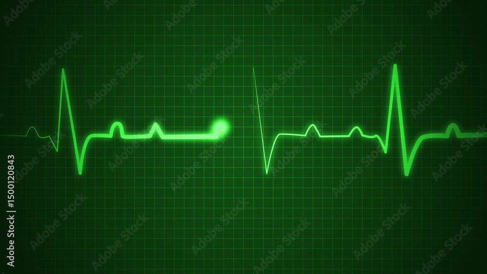 Heartbeat Signal ECG Line Animation, Electrocardiogram Heartbeat Line Signal Animation Heartbeat Signal ECG Line Animation, Electrocardiogram Heartbeat Line Signal Animation