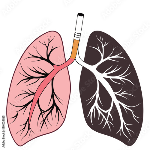 Anatomical Illustration of Human Lungs Showing Healthy Pink Tissue Versus Smoker's Blackened Lung with Tree-Like Airways and Large Cigarette Overlay – Educational Anti-Smoking Visual