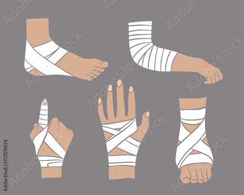 Vector isolated illustration of a set of bandaging of a leg and arm. First aid for limb sprains.
