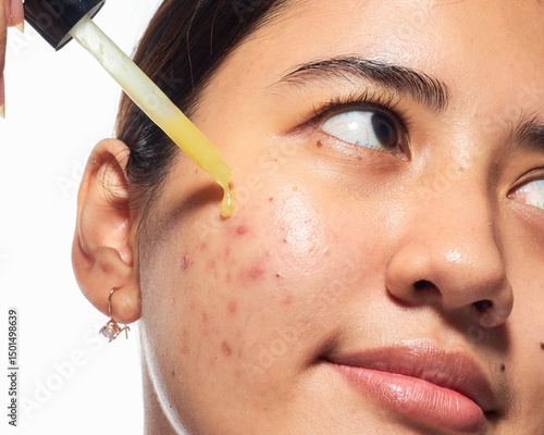 South East Asian Indonesian Women Applying Skincare Serum on Natural Pimple Face Condition in Bright Setting