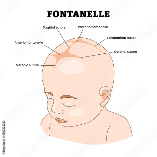 Fontanelle or soft spots, educational medical poster design healthcare scheme, labeled infant membranous gaps skull bones, anterior, posterior, sagittal, metopic, lambdoid, coronal suture.