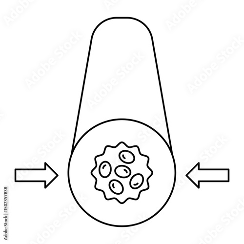 vasoconstriction