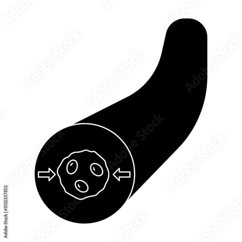 vasoconstriction