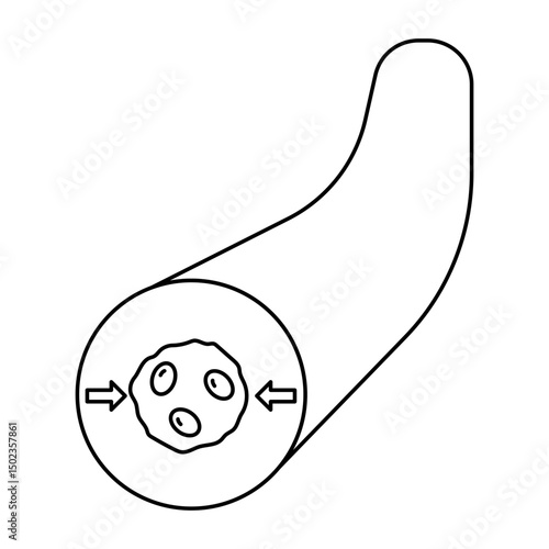 vasoconstriction