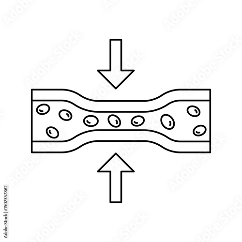 vasoconstriction