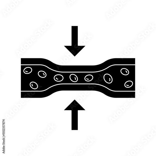 vasoconstriction
