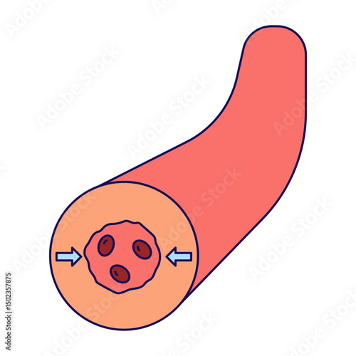 vasoconstriction