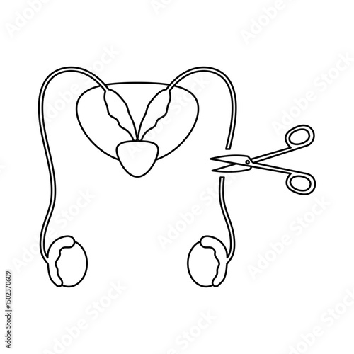 Vasectomy illustratrion