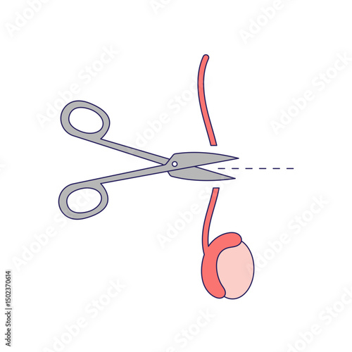 Vasectomy illustratrion