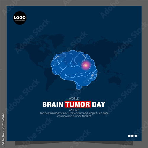 World Brain Tumor Day, observed annually on June 8th, raises awareness about brain tumors