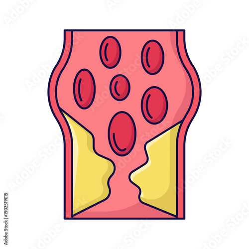 arthery disease
