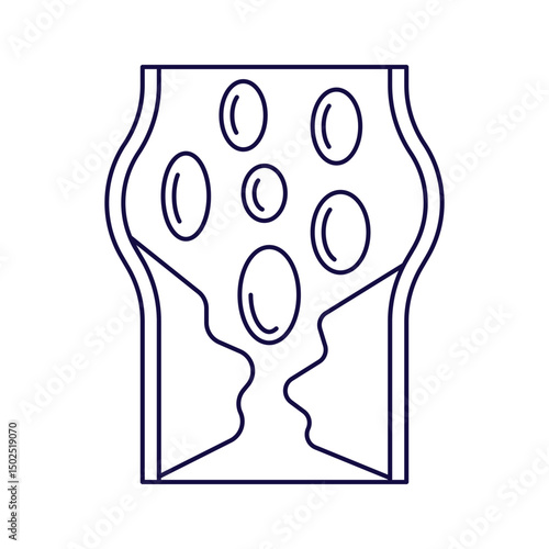arthery disease