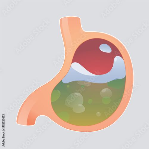 Cartoon image of liquid medicine easing acid reflux or reducing stomach acid.