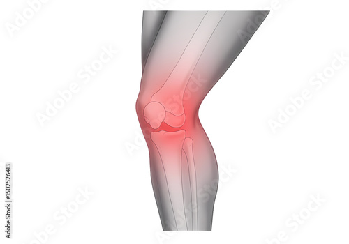 Knee Pain Causes Symptoms Treatment  Relief  Doctor Guide isolated on transparent background