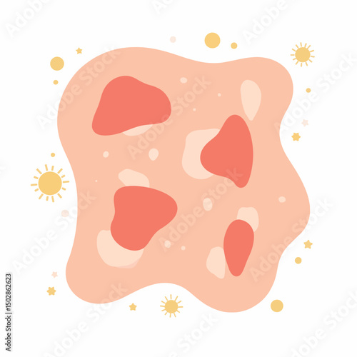 Abstract sunburned skin illustration with sun icons, minimalistic design