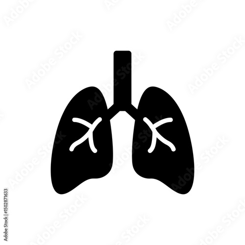 Bronchitis Illustration Showing Inflamed Bronchial Tubes and Respiratory Infection