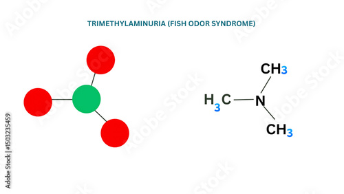 A medical illustration of trimethylaminuria fish odor syndrome disorder