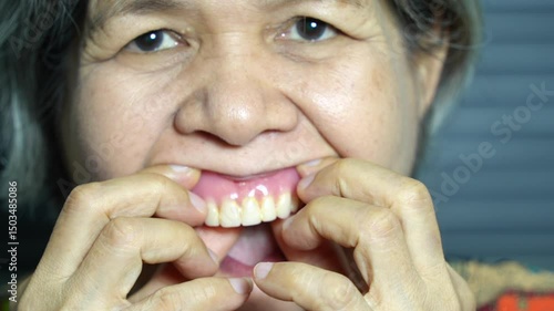 An elderly Asian woman experiments with removing and replacing her dentures to get a better fit.