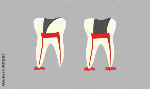 Dental teeth infection disease vector illustration