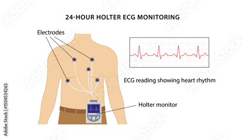 24-hour Holter ECG monitoring. Electrocardiogram. Heart cardiogram. ECG reading showing heart rhythm. Vector illustration in flat style isolated on white background