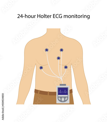 24-hour Holter ECG monitoring. Electrocardiogram. Heart cardiogram. Vector illustration in flat style isolated on white background